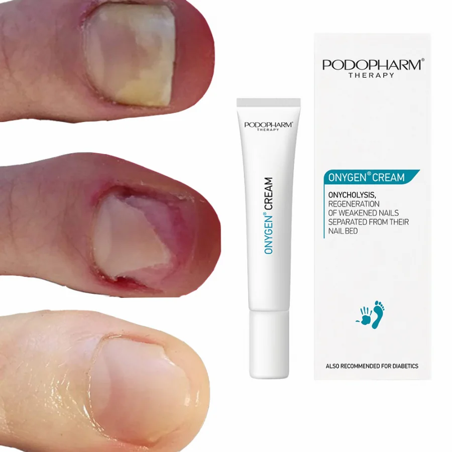 Podopharm Onygen krém – Regeneračný krém na oslabené nechty a nechtové lôžko 20 ml 
