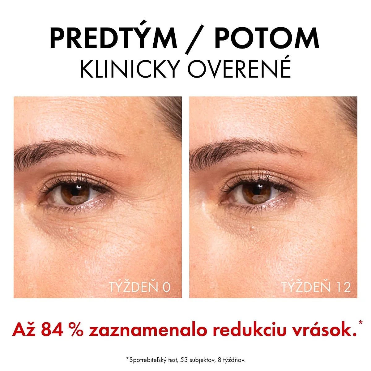 VICHY Liftactiv Collagen Specialist 16 sérum 1×30 ml, sérum