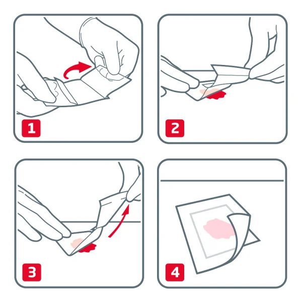 Leukoplast® Cuticell® contact 1×5ks, sterilná náplasť
