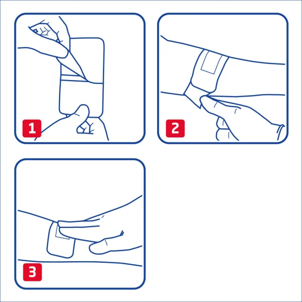 Leukoplast® elastic náplasť na rany, 2 veľkosti (inov.2020/2021) 1x20 ks