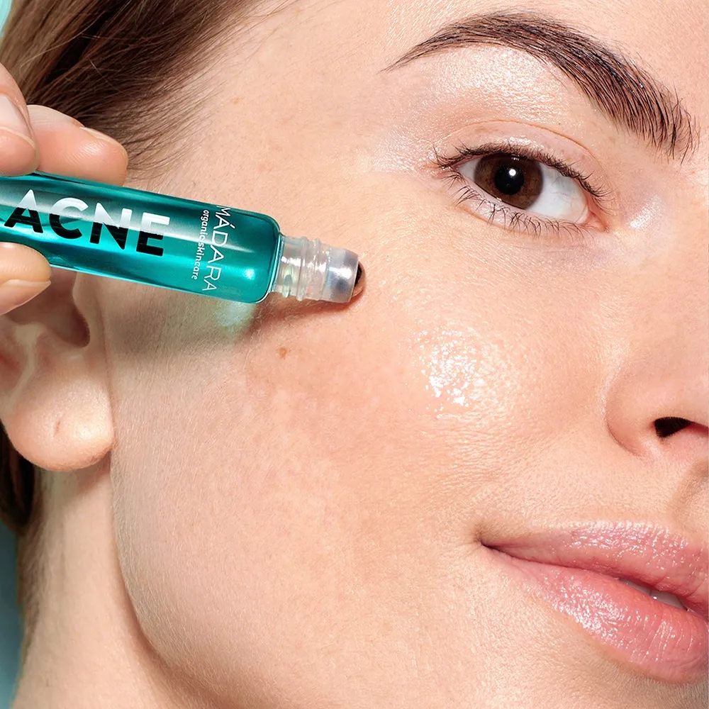 Mádara ACNE, Akútna Roll-On Na Pupienky 1×8 ml, prírodný koncentrát proti akné