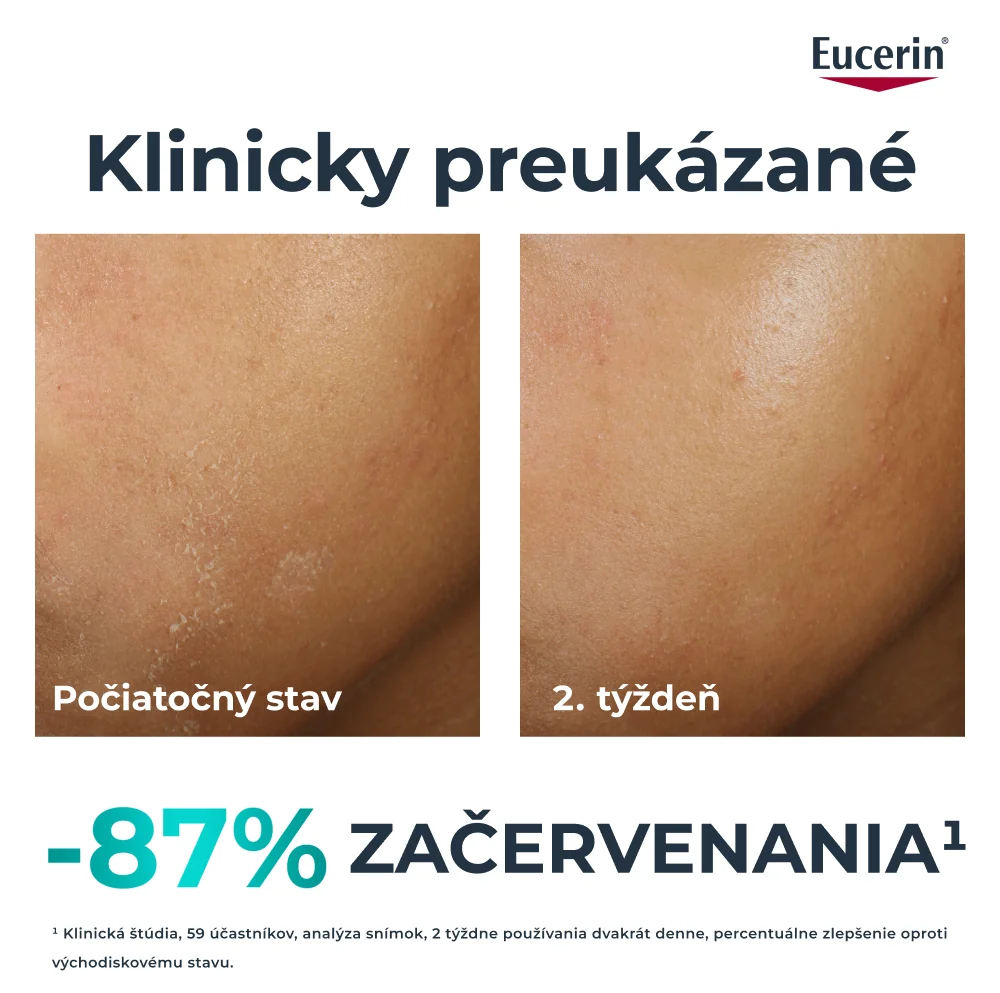 Eucerin DERMOPURE CLINICAL Obnovujúci hydratačný krém 40 ml