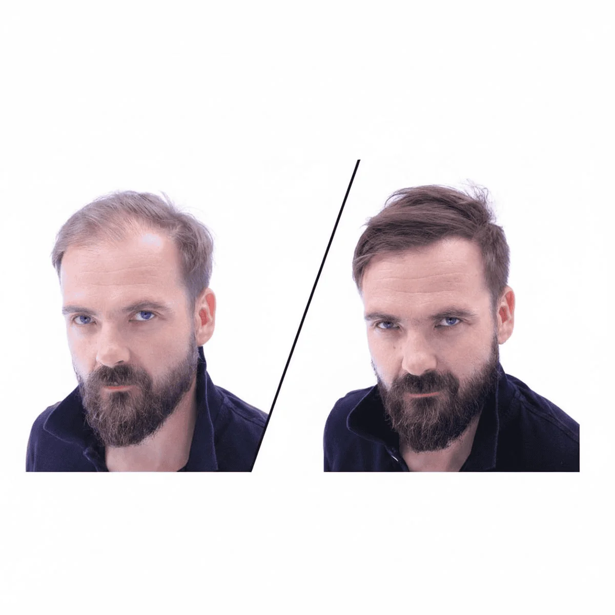 Zahusťovač pre okamžité zahustenie vlasov + FIXÁTOR Havrania čierna (Jet Black)