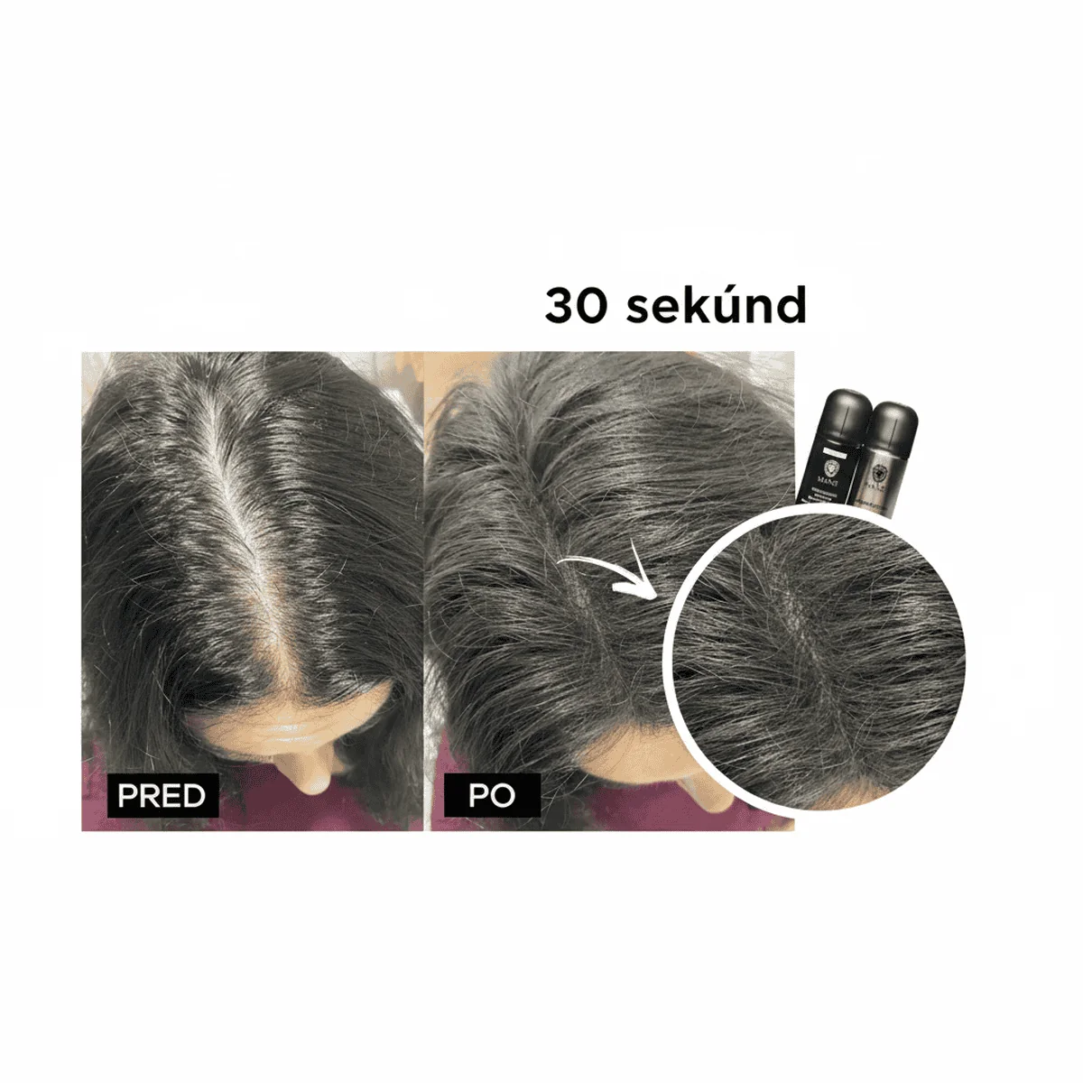 Zahusťovač pre okamžité zahustenie vlasov + FIXÁTOR Stredne hnedá (Mid Brown)