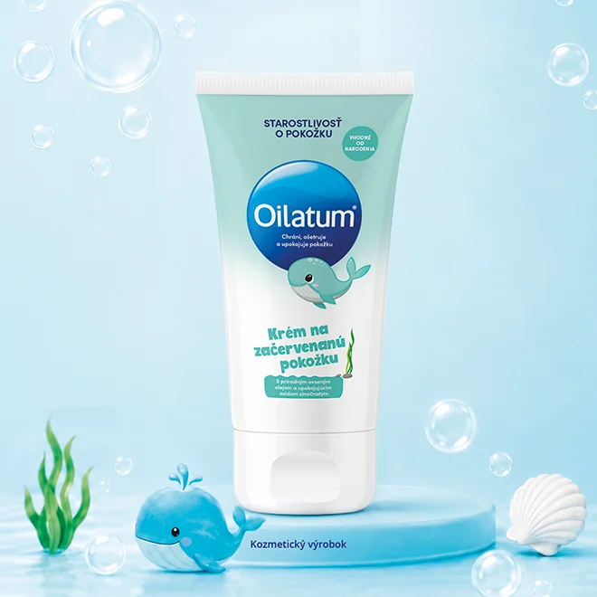 Oilatum krém na začervenanú pokožku 1×100 ml, krém na začervenanú pokožku