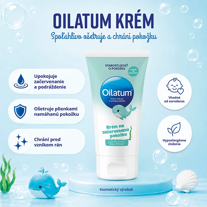 Oilatum krém na začervenanú pokožku 1×100 ml, krém na začervenanú pokožku