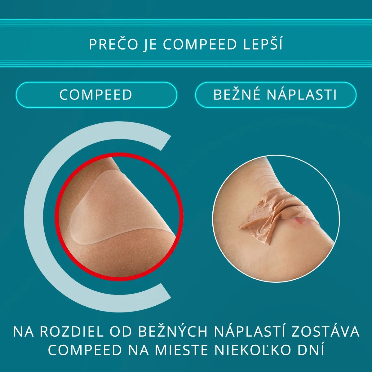 Compeed náplasť na pľuzgiere 1×6 ks, náplasť na pľuzgiere