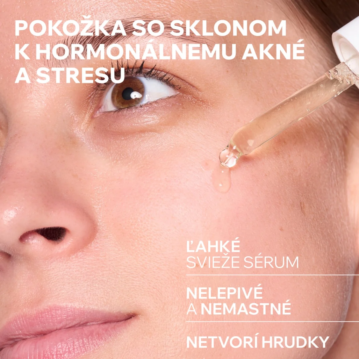 URIAGE HYSÉAC New Skin Serum 1×30 ml, sérum na mastnú pleť s nedokonalosťami