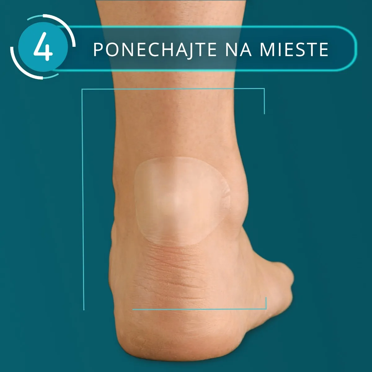 Compeed NÁPLASŤ na pľuzgiere MIX 1×5 ks, náplaste MIX