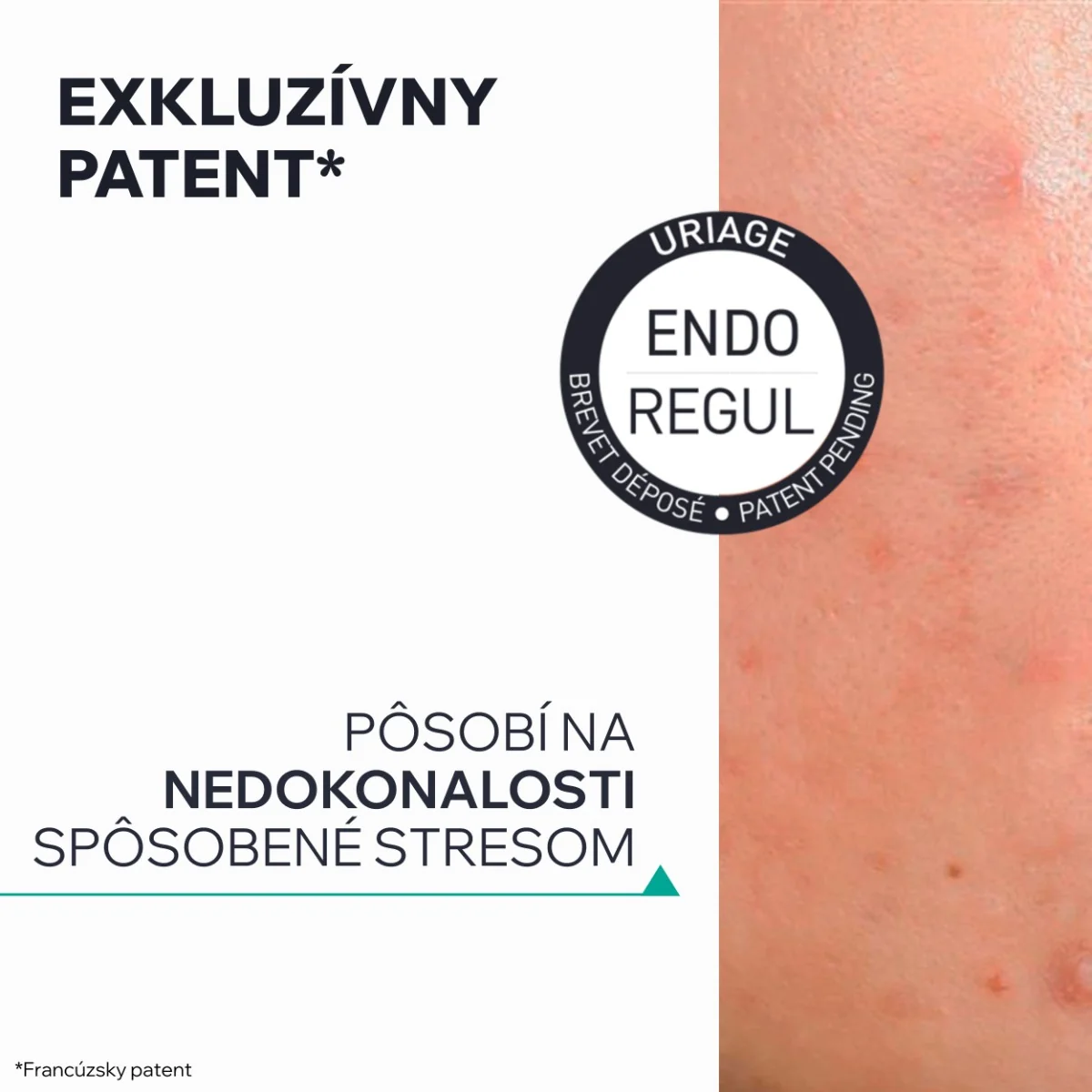 URIAGE HYSÉAC New Skin Serum 1×30 ml, sérum na mastnú pleť s nedokonalosťami