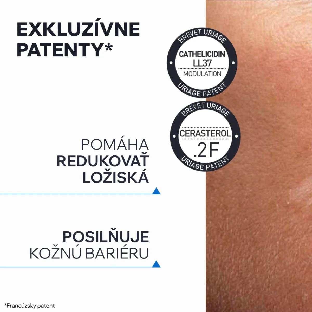 URIAGE XÉMOSE PSO Soothing Concentrate, 150ml 1×150 ml, starostlivosť o pokožku so psoriázou