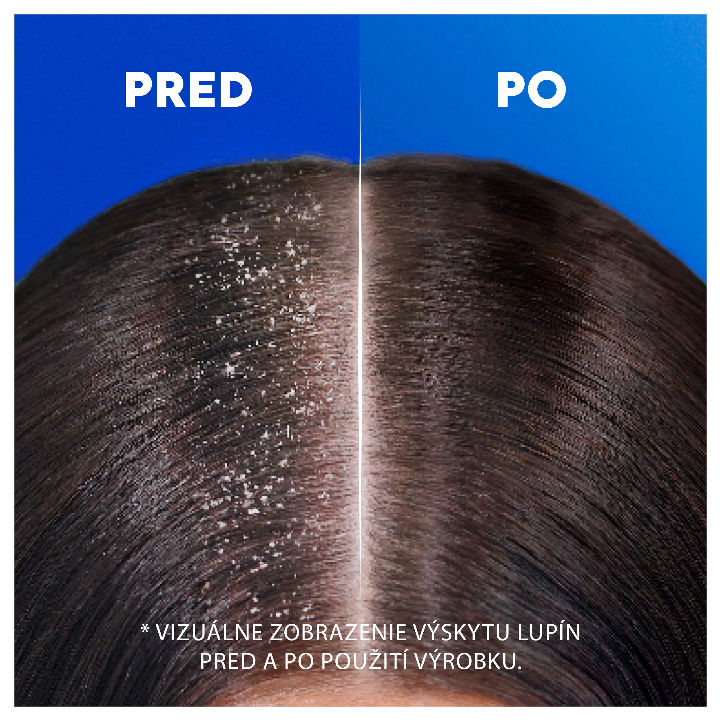 Head & Shoulders Deep Hydration Šampón 1×250, šampón