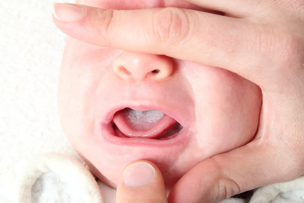 Prípravky pre ústnu dutinu, krémy a čapíky - ako ich používať u detí?