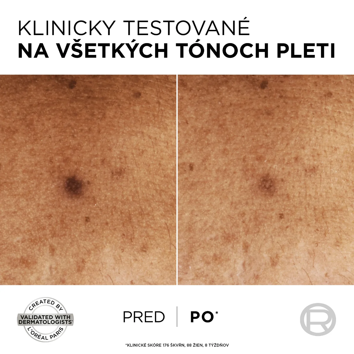 L'Oréal Paris Bright Reveal sérum proti tmavým škvrnám s niacínamidom 1×30 ml, sérum