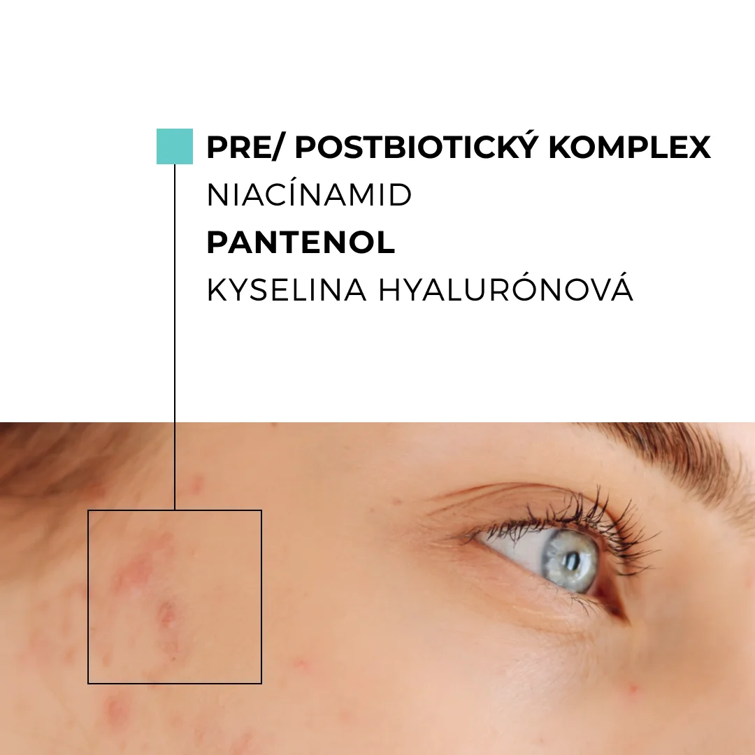 Skinexpert by Dr. Max® ACNEPRO Face Cream 1×50 ml, krém na tvár proti nedokonalostiam