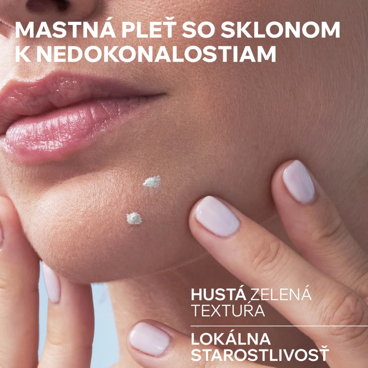 URIAGE HYSEAC SOS Paste 1x15 g, lokálna starostlivosť pre mastnú pleť s nedokonalosťami